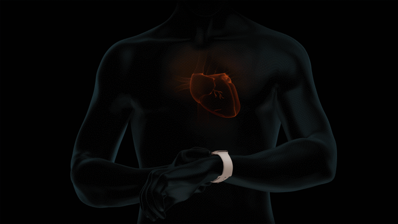 Apple Watch ECG 心電図機能