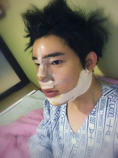korean-boy-before-and-after-surgery-2.jpg