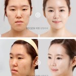 plastic-surgery-in-korea-1.jpg