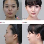 plastic-surgery-in-korea-10.jpg
