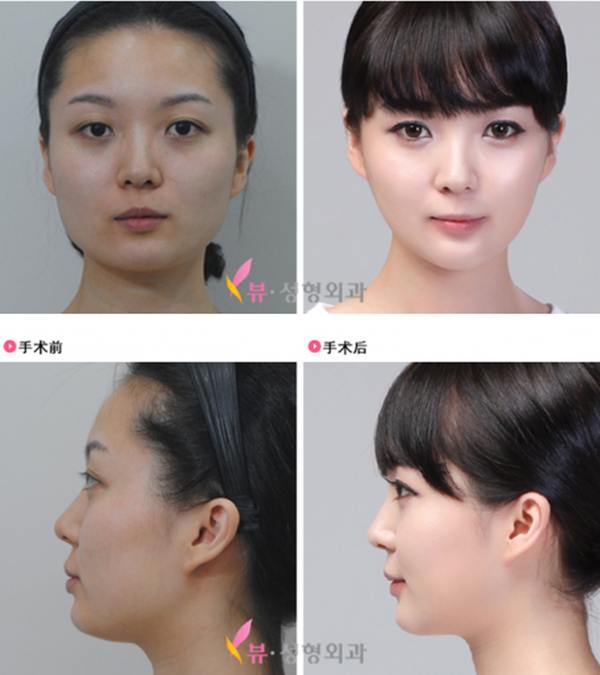 plastic-surgery-in-korea-10.jpg