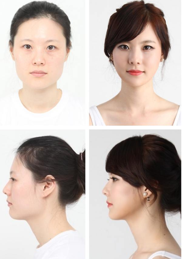plastic-surgery-in-korea-2.jpg