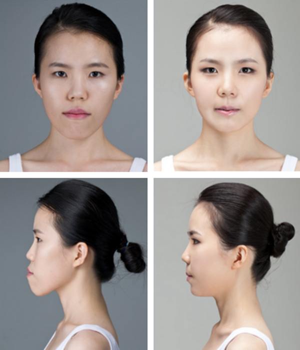 plastic-surgery-in-korea-3.jpg
