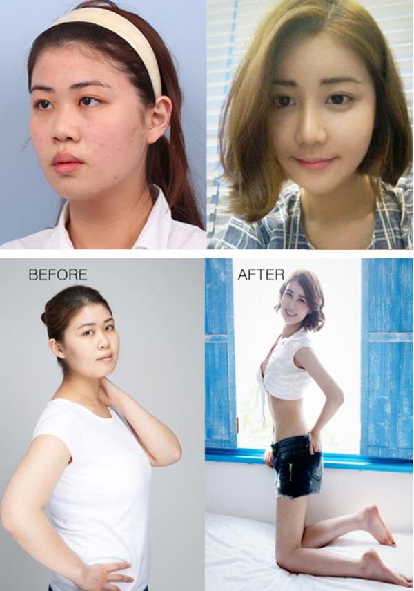 plastic-surgery-in-korea-5.jpg