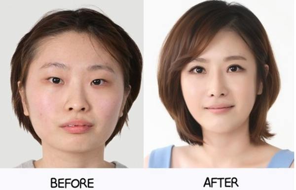 plastic-surgery-in-korea-6.jpg