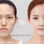 plastic-surgery-in-korea-7.jpg