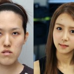 plastic-surgery-in-korea-9.jpg