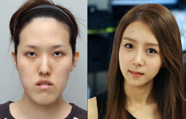 plastic-surgery-in-korea-9.jpg