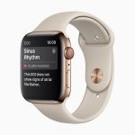 Apple-Watch-Series-4-Sinus-Rhythm-screen-12062018.jpg
