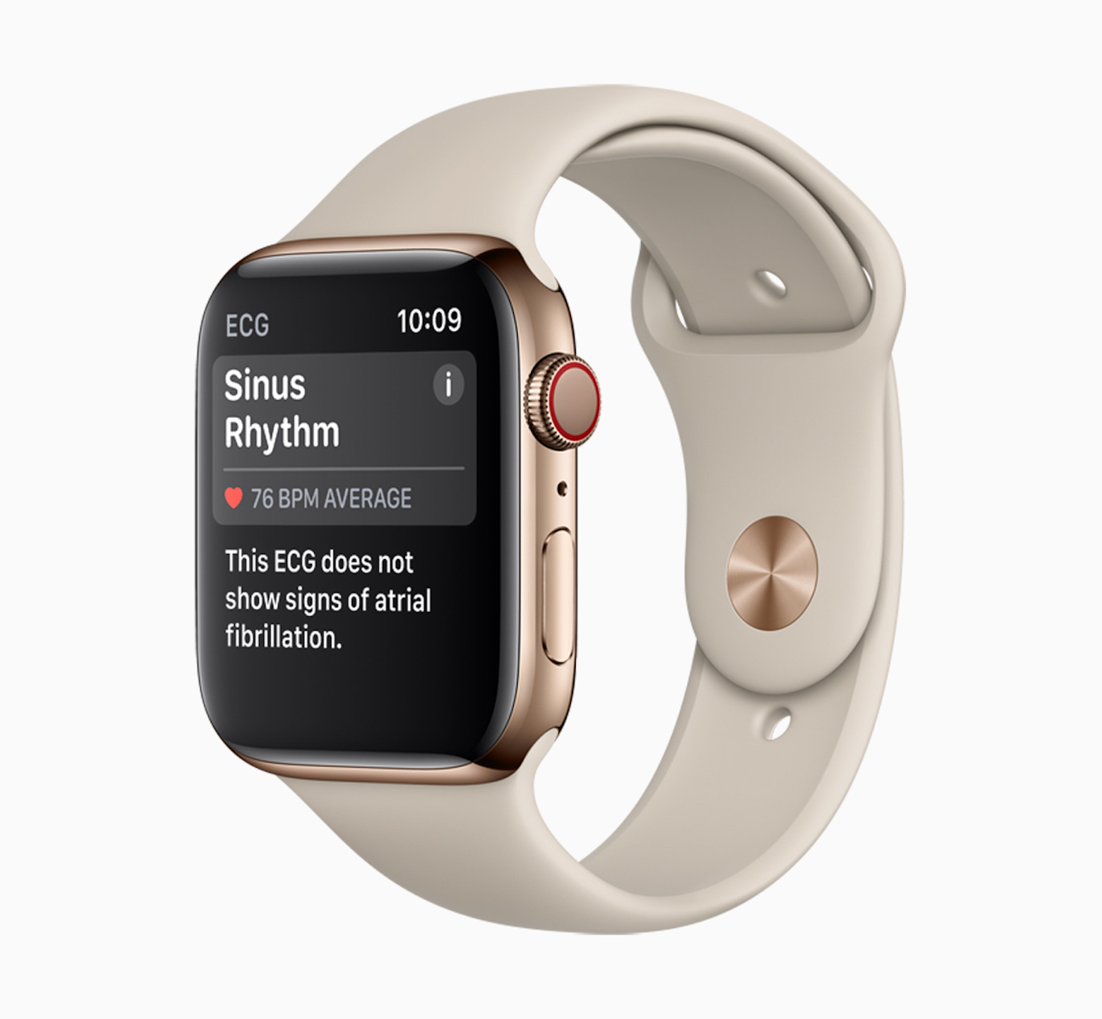 Apple-Watch-Series-4-Sinus-Rhythm-screen-12062018.jpg