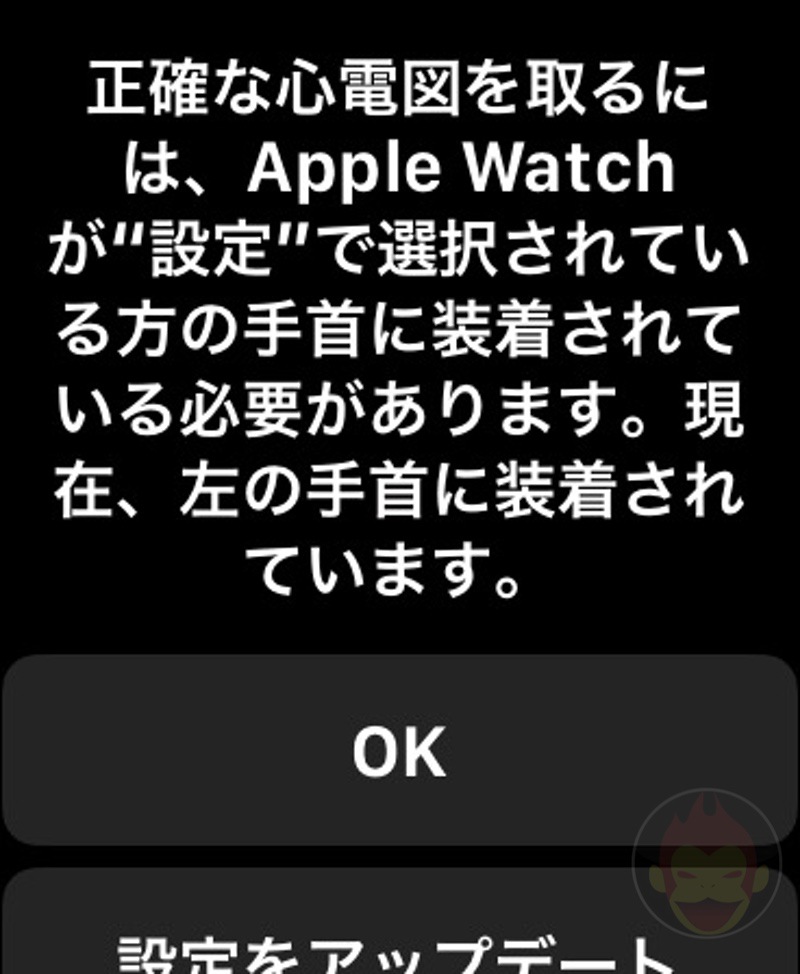 Apple Watch ECG App 02