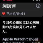 Apple-Watch-ECG-App-03.jpg