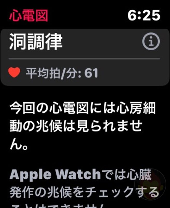 Apple-Watch-ECG-App-03.jpg