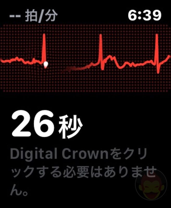 Apple-Watch-ECG-App-04.jpg