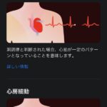 Apple-Watch-ECG-App-Setup-Howto-07.jpg