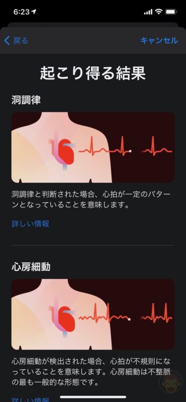 Apple-Watch-ECG-App-Setup-Howto-07.jpg