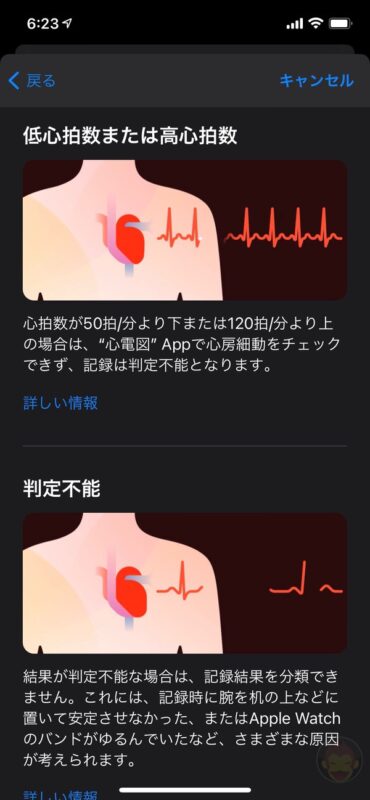 Apple-Watch-ECG-App-Setup-Howto-08.jpg
