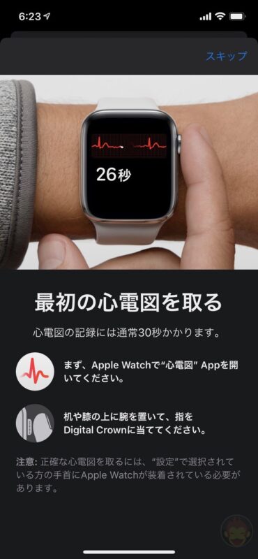 Apple-Watch-ECG-App-Setup-Howto-13.jpg