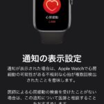 Apple-Watch-ECG-App-Setup-Howto-24.jpg