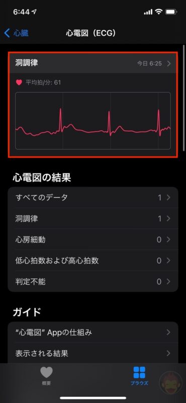 Apple-Watch-ECG-App-Setup-Howto-26.jpg