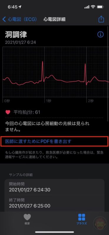 Apple-Watch-ECG-App-Setup-Howto-27.jpg